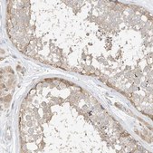 Anti-ETHE1 antibody produced in rabbit Prestige Antibodies&#174; Powered by Atlas Antibodies, affinity isolated antibody, buffered aqueous glycerol solution, ab2