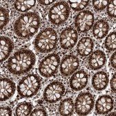 Anti-CWC22 antibody produced in rabbit Prestige Antibodies&#174; Powered by Atlas Antibodies, affinity isolated antibody, buffered aqueous glycerol solution