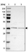 Anti-ELP5 antibody produced in rabbit Prestige Antibodies&#174; Powered by Atlas Antibodies, affinity isolated antibody, buffered aqueous glycerol solution