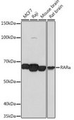 Anti-RAR&#945; antibody produced in rabbit