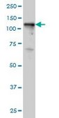 ANTI-TYK2 antibody produced in mouse clone 5A4, purified immunoglobulin, buffered aqueous solution