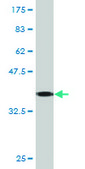 Monoclonal Anti-KRT8 antibody produced in mouse clone 3E3, purified immunoglobulin, buffered aqueous solution