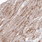Monoclonal Anti-LAMA2 antibody produced in mouse Prestige Antibodies&#174; Powered by Atlas Antibodies, clone CL3450, purified immunoglobulin, buffered aqueous glycerol solution