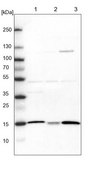 Anti-ATP5D antibody produced in rabbit Prestige Antibodies&#174; Powered by Atlas Antibodies, affinity isolated antibody, buffered aqueous glycerol solution