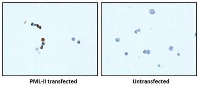 Anti-PML Isoform II Antibody, clone 1A8.1 clone 1A8.1, from mouse