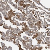 Anti-DDIT4 antibody produced in rabbit Prestige Antibodies&#174; Powered by Atlas Antibodies, affinity isolated antibody, buffered aqueous glycerol solution