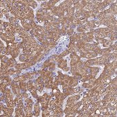 Anti-MGST1 antibody produced in rabbit Prestige Antibodies&#174; Powered by Atlas Antibodies, affinity isolated antibody, buffered aqueous glycerol solution