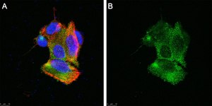 Anti-TRPA1 Antibody, clone 2N14 ZooMAb&#174; Rabbit Monoclonal recombinant, expressed in HEK 293 cells