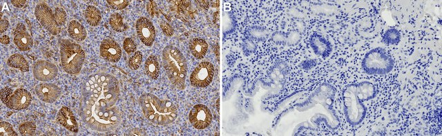 Anti-Claudin-18 Antibody, clone 1G17 ZooMAb&#174; Rabbit Monoclonal recombinant, expressed in HEK 293 cells