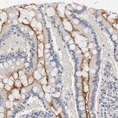 Anti-SLC10A2 antibody produced in rabbit Prestige Antibodies&#174; Powered by Atlas Antibodies, affinity isolated antibody, buffered aqueous glycerol solution