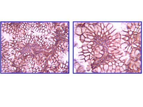 Anti-Laminin gamma 1 Antibody, clone A5 clone A5, Chemicon&#174;, from rat