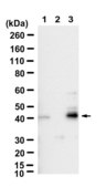 Anti-SPHK1 Antibody, clone 2H5 ZooMAb&#174; Rabbit Monoclonal recombinant, expressed in HEK 293 cells