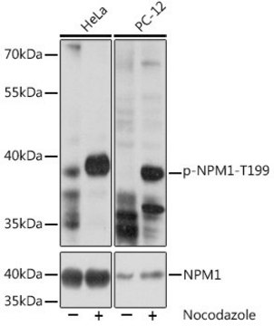 Anti-Phospho-NPM1-T199 antibody produced in rabbit