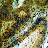 Anti-phospho-CXCR4 (pSer339) antibody produced in rabbit affinity isolated antibody