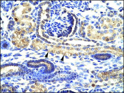 Anti-SNAI1 affinity isolated antibody