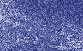 Anti-JAK2 Antibody, clone 1L13 ZooMAb&#174; Rabbit Monoclonal recombinant, expressed in HEK 293 cells