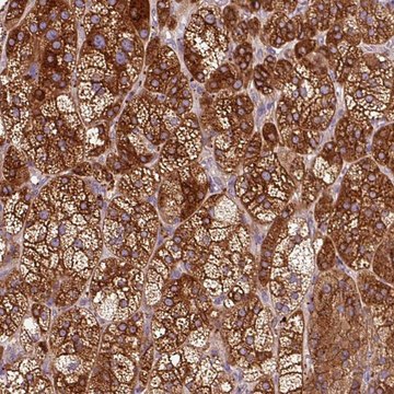 Anti-TBC1D4 antibody produced in rabbit Prestige Antibodies&#174; Powered by Atlas Antibodies, affinity isolated antibody, buffered aqueous glycerol solution