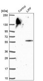 Anti-LIPF antibody produced in rabbit Prestige Antibodies® Powered by Atlas Antibodies, affinity isolated antibody, buffered aqueous glycerol solution