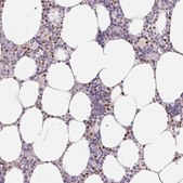 Anti-PADI4 antibody produced in rabbit Prestige Antibodies&#174; Powered by Atlas Antibodies, affinity isolated antibody, buffered aqueous glycerol solution