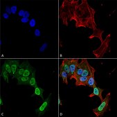 Monoclonal Anti-Sur1 - Fitc antibody produced in mouse clone S289-16, purified immunoglobulin