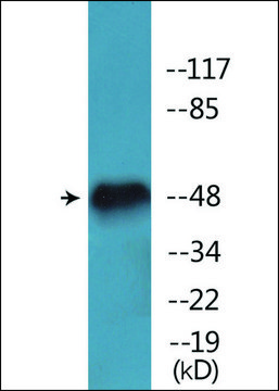 Anti-phospho-AML1 (pSer276) antibody produced in rabbit affinity isolated antibody