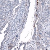 Anti-L1CAM antibody produced in mouse Prestige Antibodies&#174; Powered by Atlas Antibodies, clone CL12988, purified by using Protein A, buffered aqueous glycerol solution