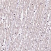 Anti-TNNT3 antibody produced in rabbit Prestige Antibodies&#174; Powered by Atlas Antibodies, affinity isolated antibody, buffered aqueous glycerol solution