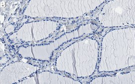 Anti-Peroxiredoxin 1 Antibody, clone 1G22 ZooMAb&#174; Rabbit Monoclonal recombinant, expressed in HEK 293 cells