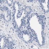 Anti-LRWD1 antibody produced in rabbit Prestige Antibodies&#174; Powered by Atlas Antibodies, affinity isolated antibody, buffered aqueous glycerol solution
