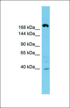 Anti-ABCC11 antibody produced in rabbit affinity isolated antibody