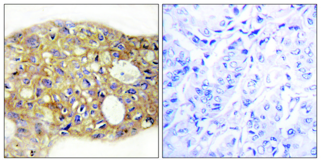 Anti-AGR3 antibody produced in rabbit affinity isolated antibody