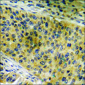 Anti-phospho-ATP-Citrate Lyase (pSer454) antibody produced in rabbit affinity isolated antibody