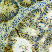 Anti-phospho-p53 (pThr18) antibody produced in rabbit affinity isolated antibody