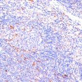 Anti-IKBKE antibody produced in rabbit