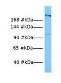 Anti-MYH1, (N-terminal) antibody produced in rabbit affinity isolated antibody