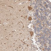 Anti-AFDN antibody produced in rabbit Prestige Antibodies&#174; Powered by Atlas Antibodies, affinity isolated antibody, buffered aqueous glycerol solution, ab2