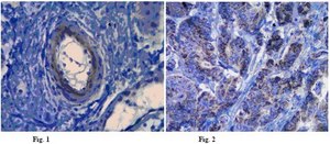 Anti-Laminin alpha 5 Antibody, clone 4B12 clone 4B12, from mouse