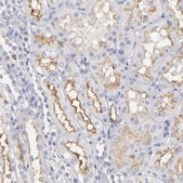 Anti-ABCB1 antibody produced in rabbit Prestige Antibodies&#174; Powered by Atlas Antibodies, affinity isolated antibody, buffered aqueous glycerol solution