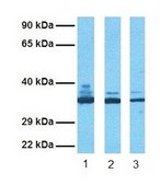 Anti-LDHA affinity isolated antibody