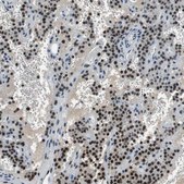 Anti-MAFB antibody produced in rabbit Prestige Antibodies&#174; Powered by Atlas Antibodies, affinity isolated antibody, buffered aqueous glycerol solution