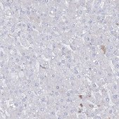 Anti-HYAL2 antibody produced in rabbit Prestige Antibodies&#174; Powered by Atlas Antibodies, affinity isolated antibody, buffered aqueous glycerol solution