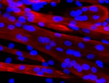 Monoclonal Anti-Myosin (Skeletal, Fast)&#8722;Alkaline Phosphatase antibody produced in mouse clone MY-32, purified from hybridoma cell culture