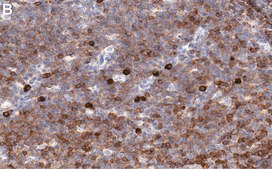 Anti-Fyn Antibody, clone 2F15 ZooMAb® Rabbit Monoclonal recombinant, expressed in HEK 293 cells