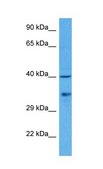Anti-IRF1 (AB2) antibody produced in rabbit affinity isolated antibody