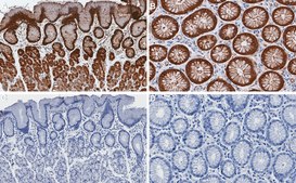 Anti-NQO1 Antibody, clone 1D12 ZooMAb® Rabbit Monoclonal recombinant, expressed in HEK 293 cells