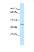 Anti-ZFP36L1 antibody produced in rabbit affinity isolated antibody
