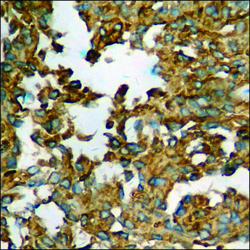 Anti-phospho-p53 (pSer37) antibody produced in rabbit affinity isolated antibody