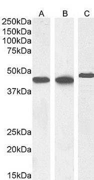 Anti-Smooth Muscle &#945;-Actin antibody produced in goat affinity isolated antibody, buffered aqueous solution