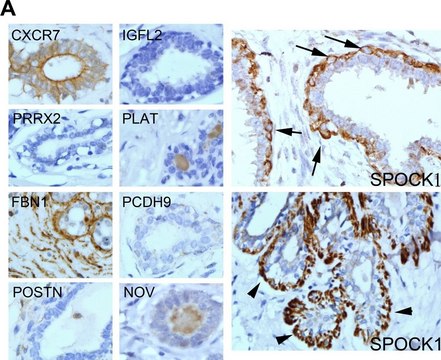 Anti-PRRX2 antibody produced in rabbit Prestige Antibodies&#174; Powered by Atlas Antibodies, affinity isolated antibody, buffered aqueous glycerol solution