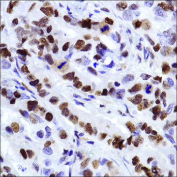 Anti-MCM2 antibody, Rabbit monoclonal recombinant, expressed in proprietary host, clone SP85, affinity isolated antibody